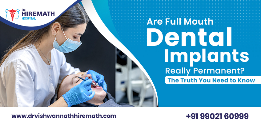 are-full-mouth-dental-implants-really-permanent